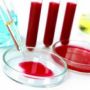 Ученые разработали новый метод очистки крови