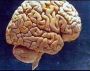 Молекулярная визуализация выявляет воспаление в мозге больных шизофренией и страдающих мигренью